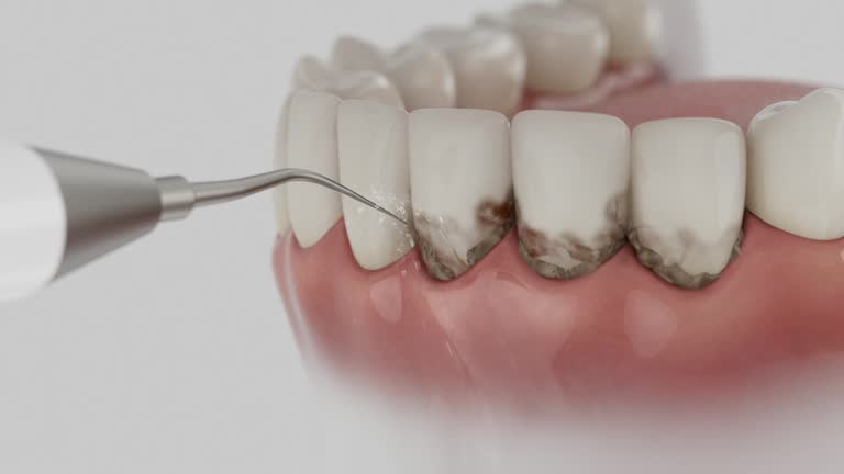 Trusted Tooth Extraction service in Tehaleh, WA - Dentist Open Now